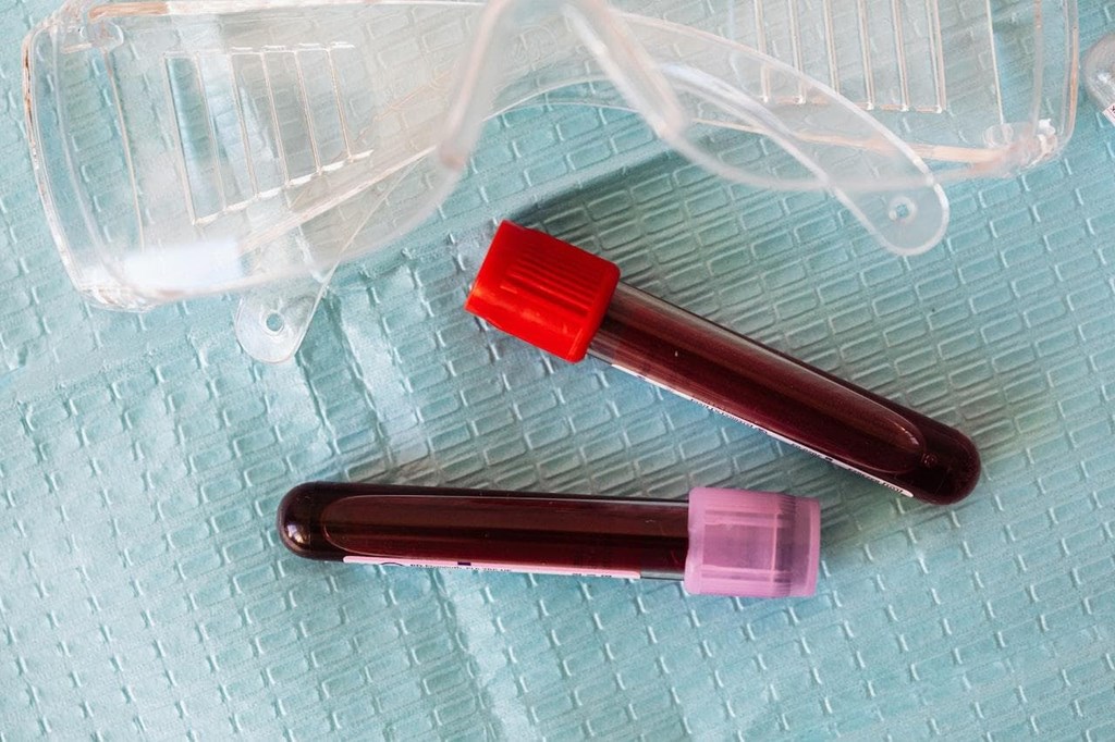 ¿Cada cuánto tiempo debemos hacernos un análisis de sangre?